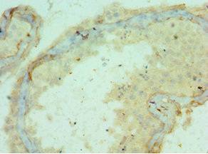 CSB-PA889097ESR1HU