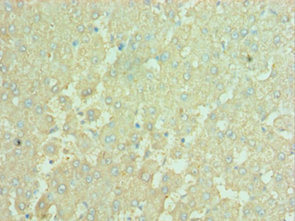 CSB-PA889097ESR1HU