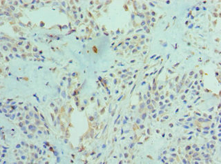 CSB-PA890757ESR2HU