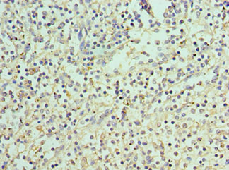 CSB-PA890757ESR2HU