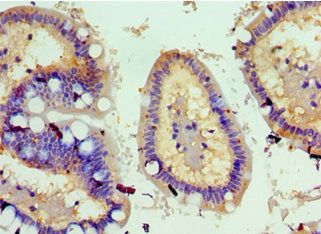 CSB-PA891791ESR1HU IHC-1