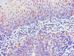 CSB-PA897497ESR1HU