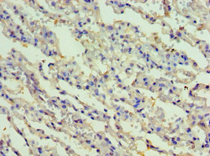CSB-PA897497ESR1HU