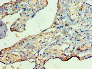 CSB-PA897497ESR1HU