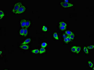 CSB-PA001367LA01HU