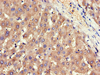 CSB-PA001367LA01HU