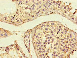 CSB-PA001376LA01HU