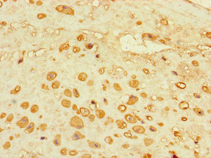 CSB-PA001376LA01HU