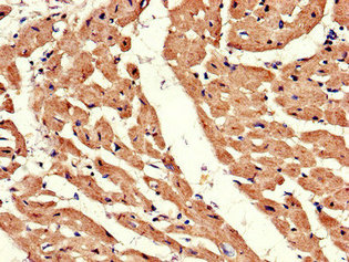 CSB-PA001391LA01HU