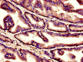 CSB-PA003641LA01HU