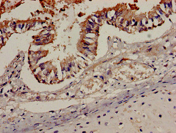 CSB-PA004846LA01HU