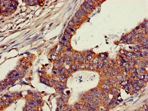CSB-PA005307LA01HU