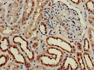 CSB-PA005307LA01HU