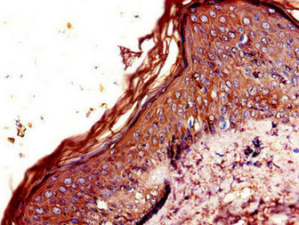 CSB-PA005679LA01HU