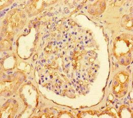 CSB-PA005922LA01HU