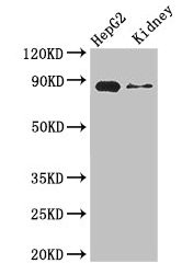 CSB-PA005922LA01HU