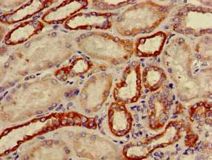 CSB-PA006391LA01HU