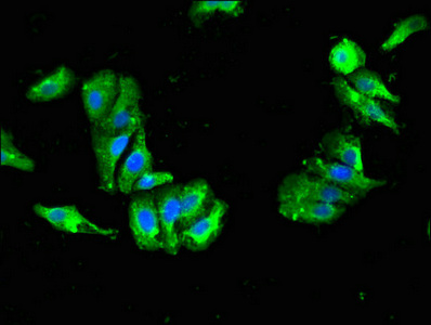 CSB-PA006583LA01HU
