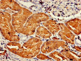 CSB-PA006583LA01HU