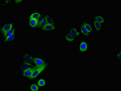 CSB-PA007766LA01HU