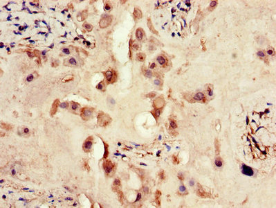 CSB-PA007766LA01HU