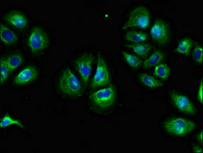 CSB-PA007925LA01HU