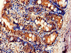 CSB-PA007925LA01HU