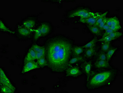 CSB-PA008651LA01HU