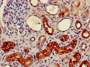 CSB-PA009087LA01HU
