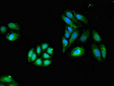 CSB-PA010084LA01HU