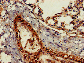 CSB-PA010084LA01HU