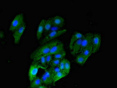 CSB-PA010737LA01HU
