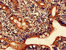 CSB-PA010737LA01HU