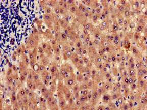 CSB-PA010737LA01HU
