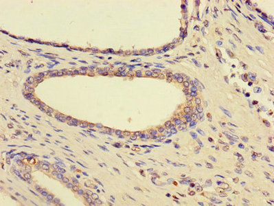 CSB-PA010830HA01HU