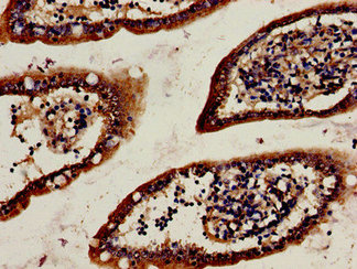 CSB-PA010881LA01HU