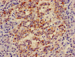 CSB-PA011830LA01HU
