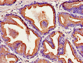 CSB-PA012453LA01HU