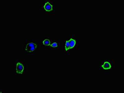 CSB-PA015344LA01HU