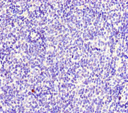 CSB-PA015344LA01HU