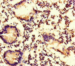 CSB-PA015344LA01HU