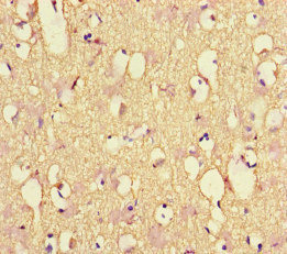 CSB-PA015688LA01HU