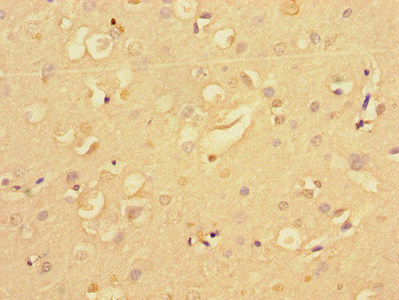 CSB-PA015741LA01HU