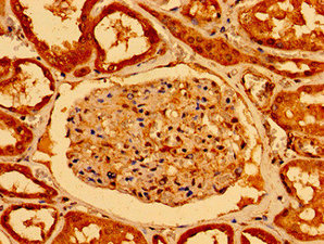 CSB-PA015950LA01HU