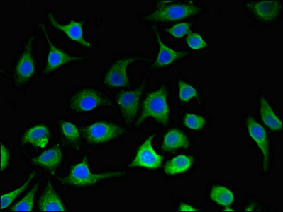 CSB-PA017511LA01HU