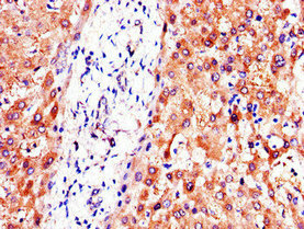 CSB-PA017511LA01HU