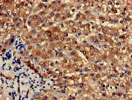 CSB-PA017522LA01HU