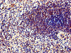 CSB-PA018583LA01HU