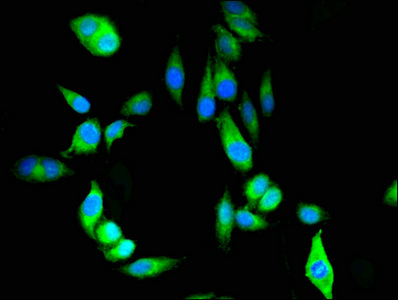 CSB-PA018659LA01HU