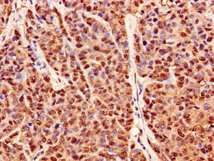 CSB-PA018659LA01HU